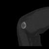 SPORK, NICO - 22.03.1976 - 02.08.2022 - CT obere Extremität - 17:59:07